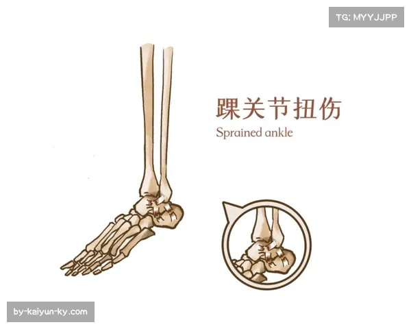 进攻节奏加快离心负荷增加 急停变向动作导致软组织撕裂